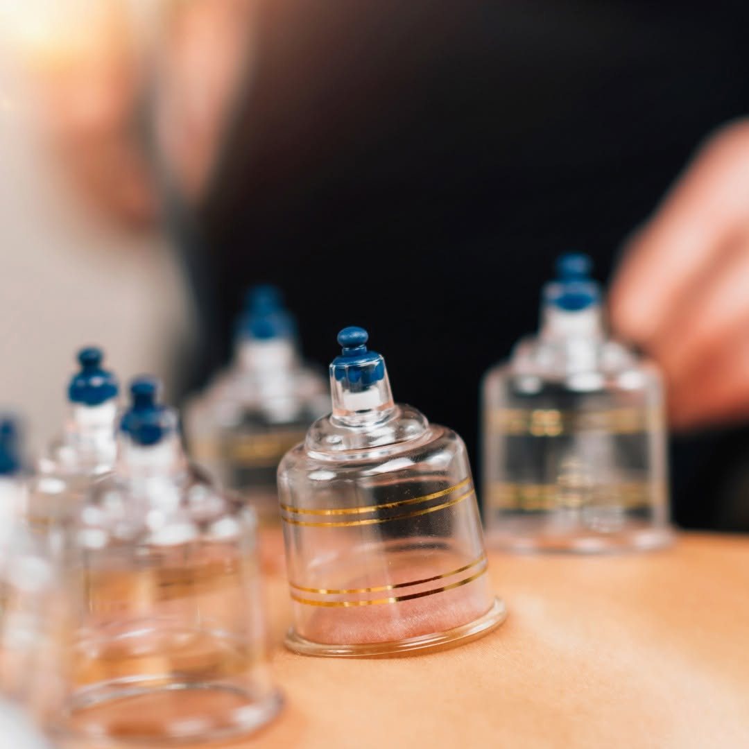 De cups liggen klaar voor een behandeling